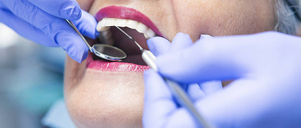 Best Emergency Dentist for Lost Fillings or Crowns in Mackinac Island, MI